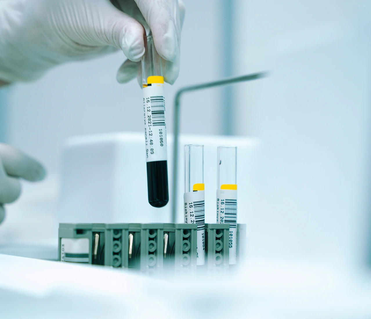 装有血液样本的临床研究用实验室试管